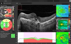 MXOPHTALMIC-OPTOPOLCOPERNICSD